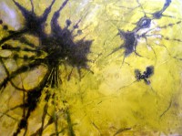 /album/pintura/neuronografia-alfa-jpg/